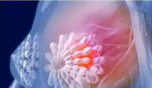 #清风计划#《小欢喜》也并不欢喜，全剧最温柔妈妈也逃不开癌症