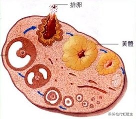 搬重物后“黄体破裂”，妇科医生告诉你这些细节你也会忽略