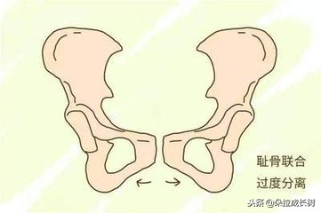 孕期该注意哪些事准妈妈进来看看,孕期的各种痛