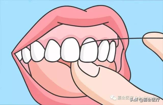 刷完牙用牙线清理牙垢多余吗,刷牙只能清洁70%的牙齿