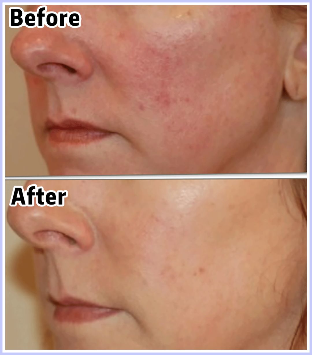 如果被祛痘机构坑了怎么办,我被私立医院骗了怎么办