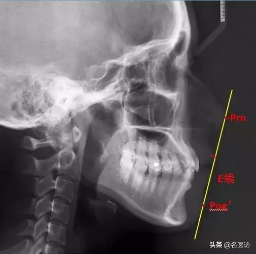 矫正牙科普馆,矫正牙齿科普知识