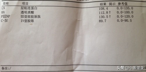 乙肝携带最新用药指南,乙肝病毒携带者的诊断及治疗