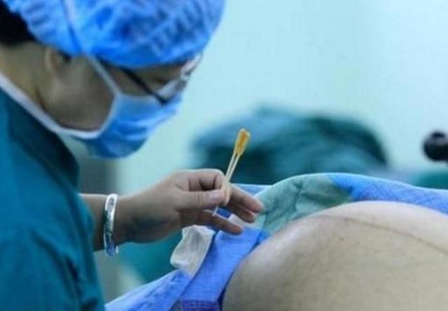 生宝宝要处理毛发吗,生孩子要刮头发吗