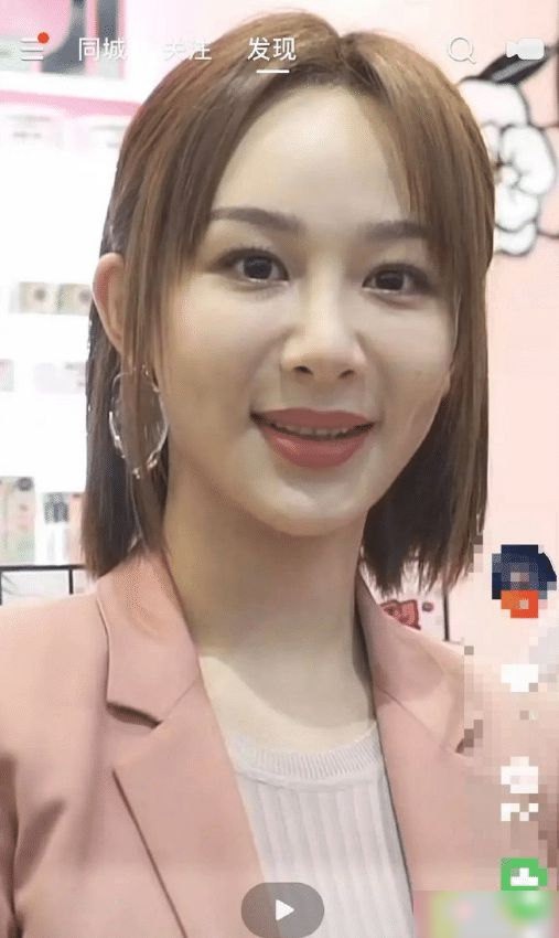 哪个明星做了颧骨内推,颧骨内推明星前后对比