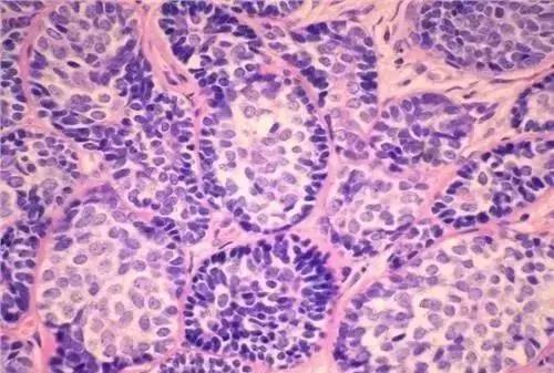 如何看懂胃镜活检报告,胃镜病理活检报告一般需几天