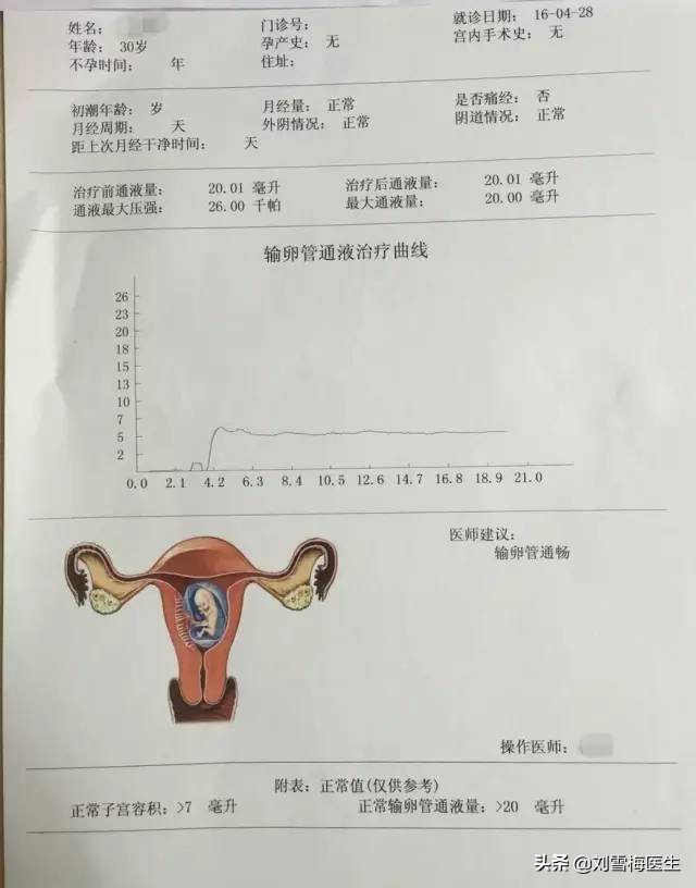 阴超可以检查输卵管堵塞吗,阴超可以检查出输卵管炎症吗