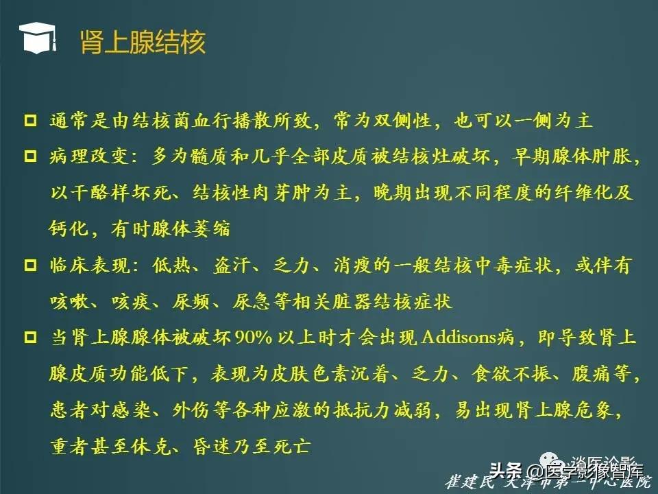 左侧肾上腺结节考虑腺瘤与增生,双侧肾上腺增生是什么原因造成的