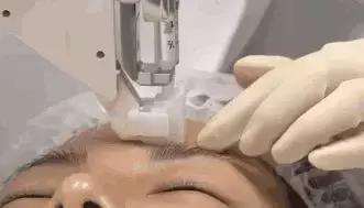 打完水光10天还是很多疙瘩,打完水光后的后遗症