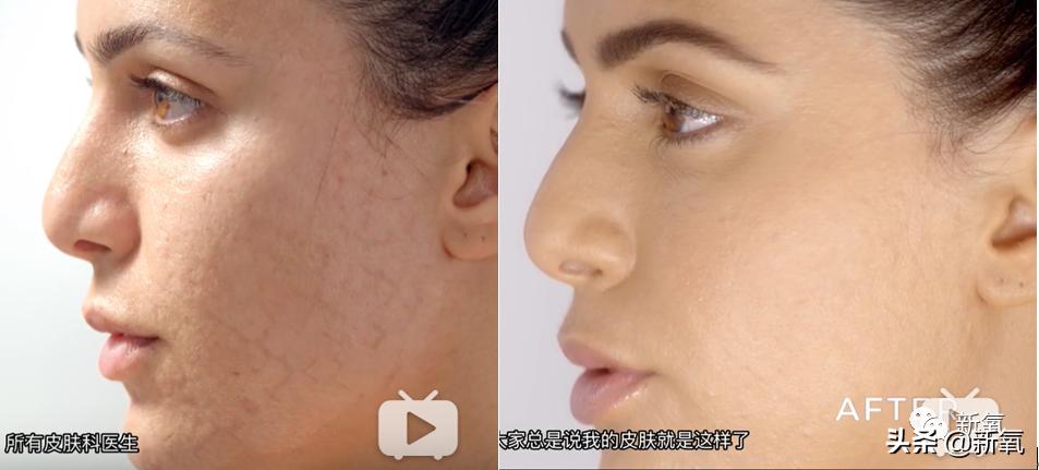 刘诗诗最近生图,刘诗诗旧照脸又胖又大