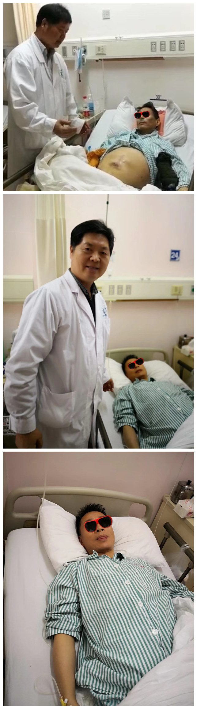 肝硬化顽固性腹水的临床研究,肝硬化失代偿糖尿病最新治疗方案