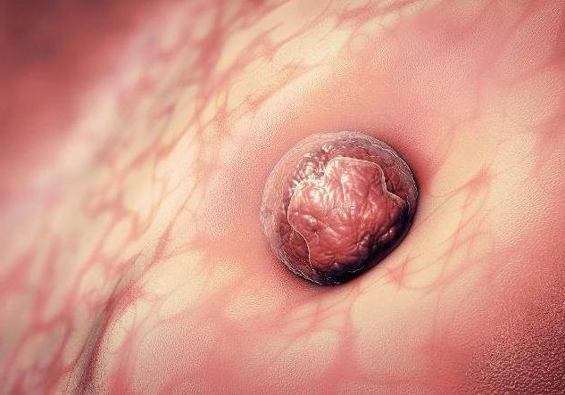 受孕卵着床成功要多少天,冻胚移植几天着床着床后什么感觉