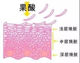 果酸换肤效果能持续多久,果酸换肤效果会持续多久