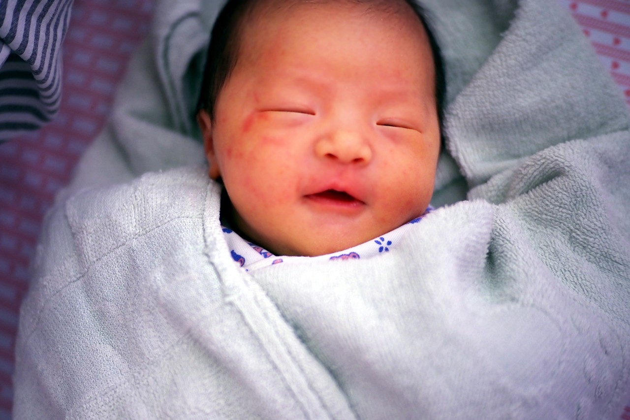 宝宝出生后不白，原因主要在爸妈，别纠结