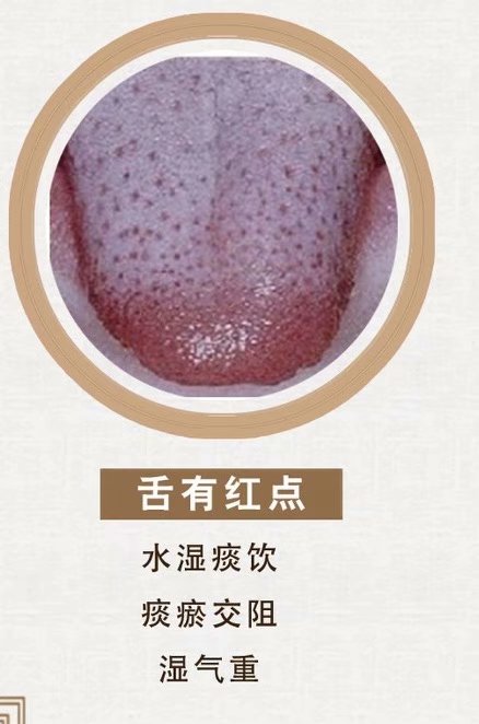 舌诊脉诊分析合集,舌诊实战分析