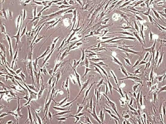 头上秃了一块还能长回来吗,二十三岁头秃还能长回来吗