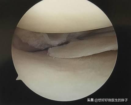 膝盖走路不怎么疼躺下就疼,儿童膝盖不动就不疼一走路就疼