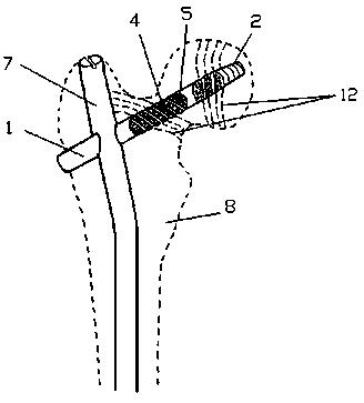 林书豪的伤病,林书豪重返赛场再次负伤