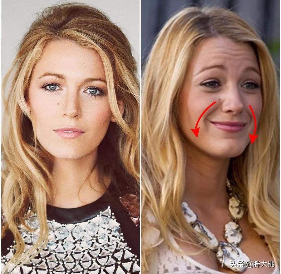 法令纹早出现还是晚出现好,什么样的人不容易长法令纹