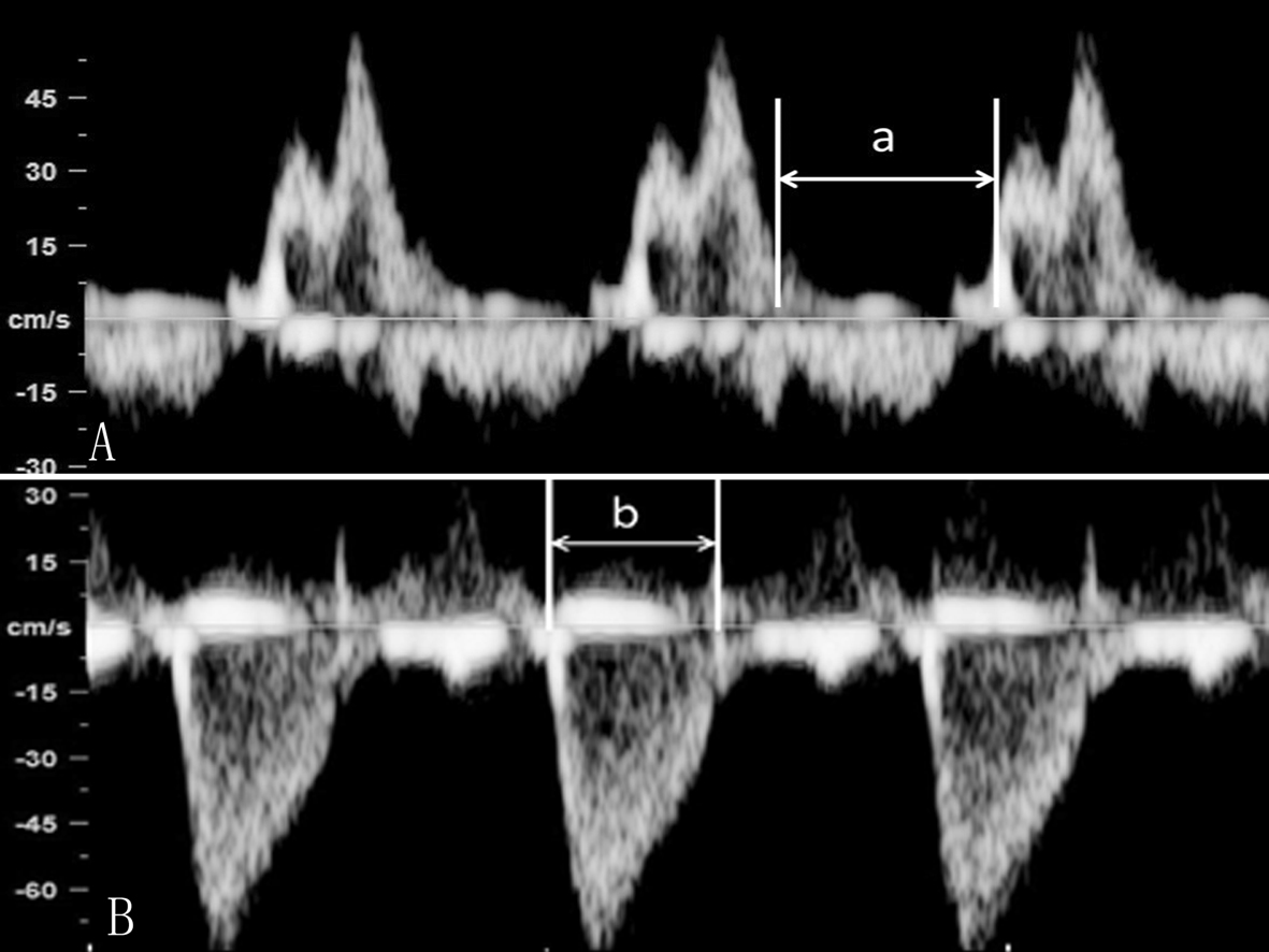做普通的彩超能不能看到胎儿心脏,做彩超能知道胎儿准确多少周吗
