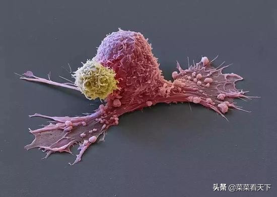癌症细胞永生,死于癌症后细胞永生