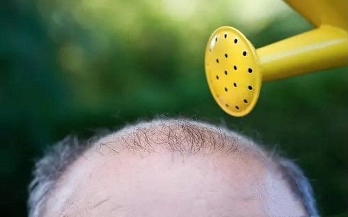 植发脱落期看不到毛孔是怎么回事,植发后脱落期和狂脱期有什么区别