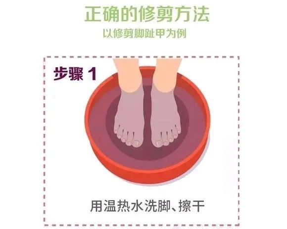 指甲老往肉里长化脓,指甲为什么一直往肉里长