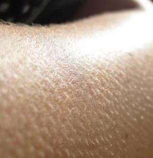 螨虫到处爬,大量螨虫