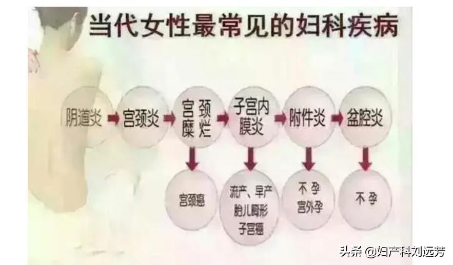 妇科过程的治疗方案是什么