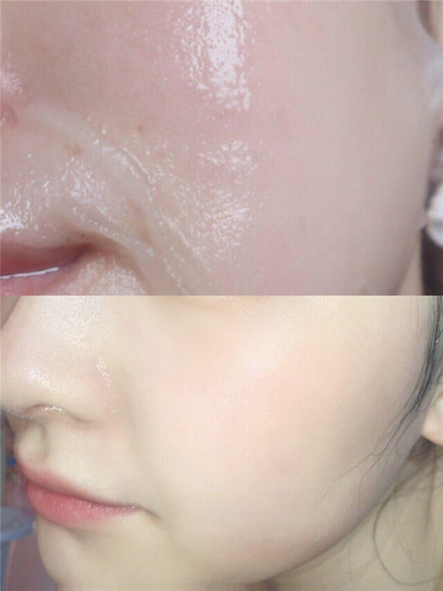 眼部有细纹用什么眼霜可以淡化,眼部有细纹怎么办