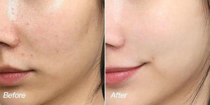 做医美的女生有多少,做医美的女生有什么特征