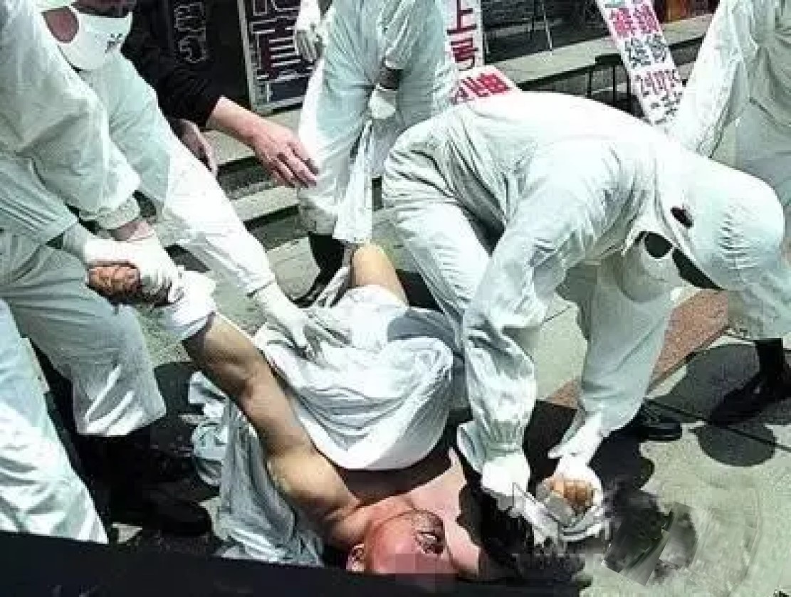 被狗咬有疯狗病吗,被疯狗咬后真的会像狗一样叫吗