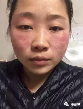 315被曝光化妆品,315被曝光的化妆品2017