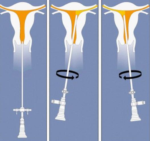 母女双得癌症最新消息,母女一起得癌症