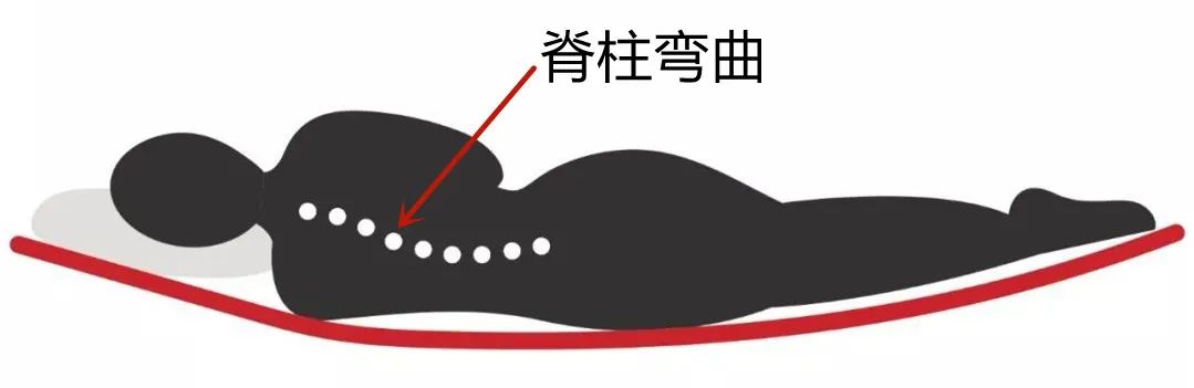 硬床好还是软包床好,腰椎间盘突出睡软床还是硬床垫好