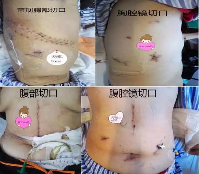 苏州科技城心胸外科主任,苏州大学第一附属医院胸外科排名