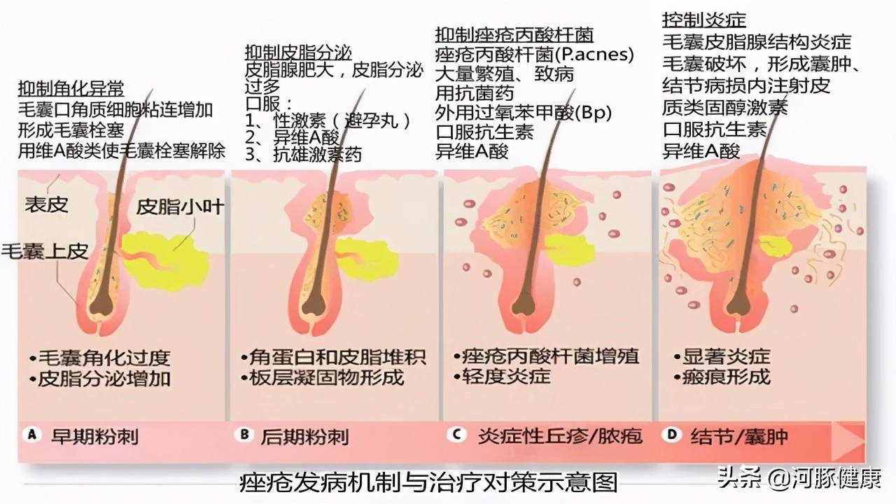 被痘痘毁掉的脸,治毒疮最好的中成药