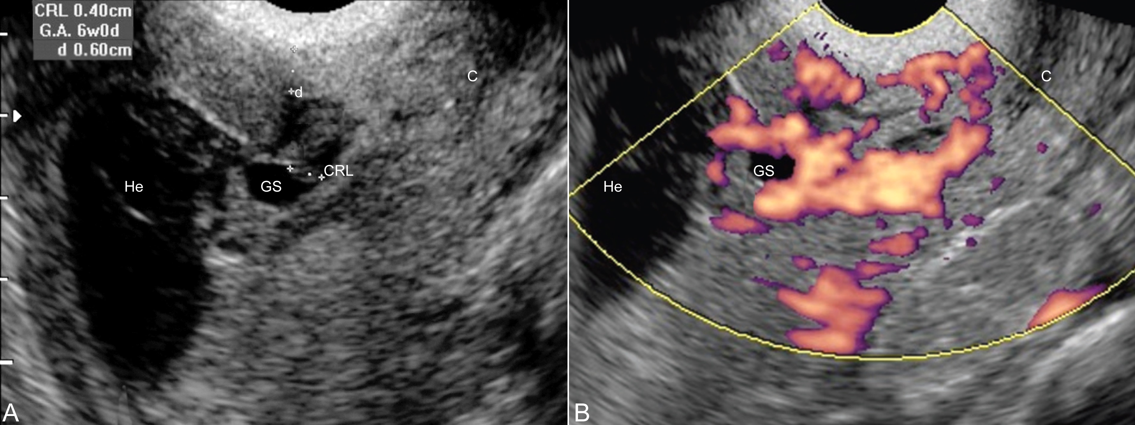 超声全腹检查视频教程,做超声全过程看肚子