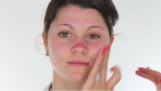 脸部泛红敷面膜刺痛,脸上长痘痘闭口泛红有刺痛皮肤干