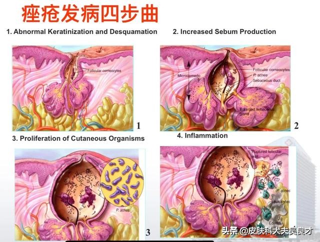 省省吧！这些常见皮肤问题，护肤品根本解决不了