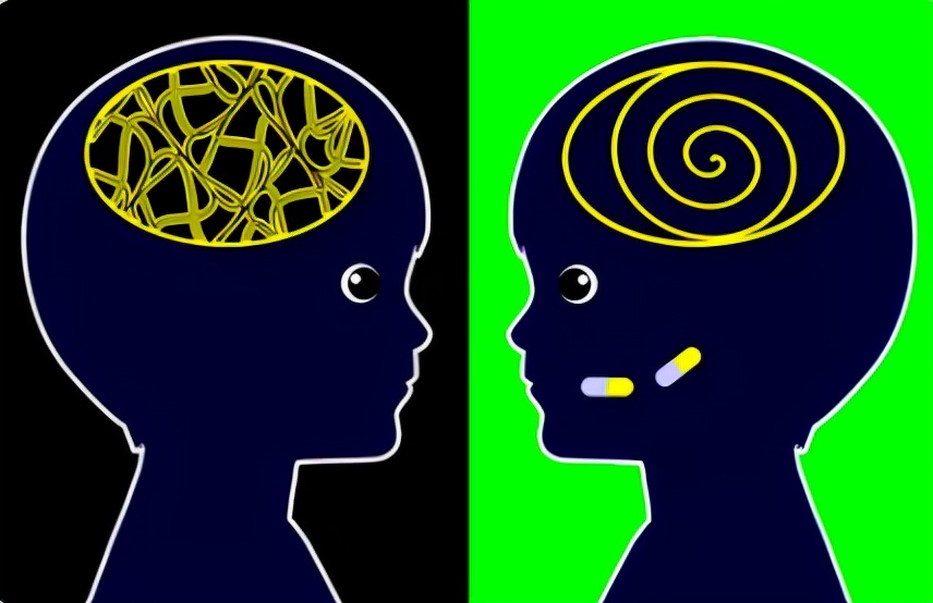 怎么判断间歇性外斜视,间歇性外斜视怎么算是严重