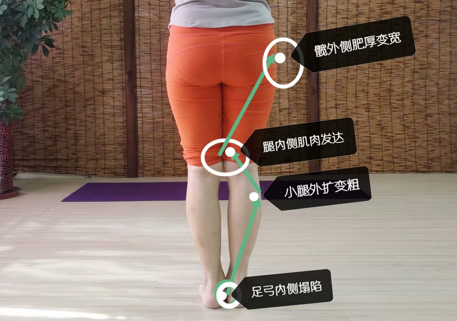 小腿粗怎么走路瘦小腿,小腿肚子如何变瘦