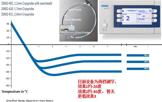 孙加源门诊,治疗肺癌的新技术新手段