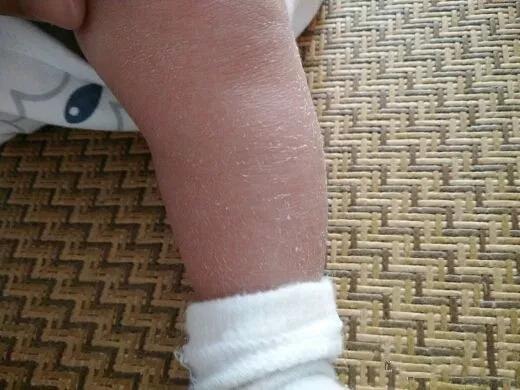 宝宝的10个“伪异常”现象,初为父母的你,遇到之后不要慌