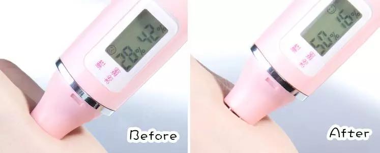 脂肪粒别用针挑教你一个土办法,脂肪粒怎么用针挑出来不疼