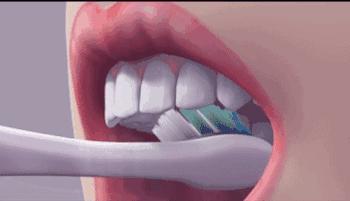 牙齿上火牙龈痛怎么止痛,牙龈肿是牙齿坏了还是上火引起的