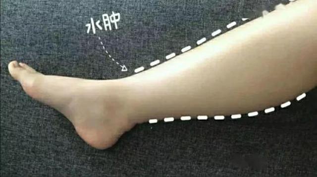 脚踝变粗还能长高吗,脚踝粗显矮