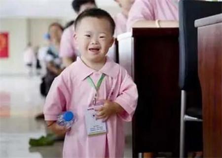 为什么唐氏儿童的脸长得差不多,为什么唐氏患儿长得都一样