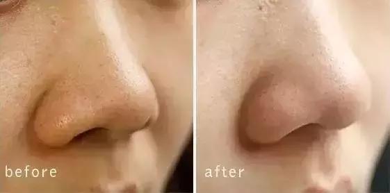 护肤反而皮肤差,改掉这些护肤恶习让你越变越美丽