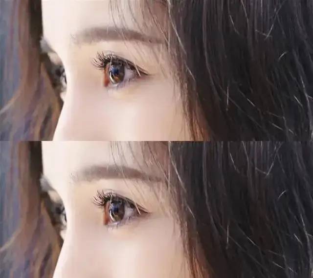 死鱼眼怎么变成炯炯有神的眼神,死鱼眼怎么变成炯炯有神的大眼